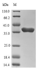 Human TSG101 protein