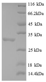 Recombinant Human FOXP3 Protein