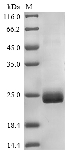 Mouse Pla2g12a protein