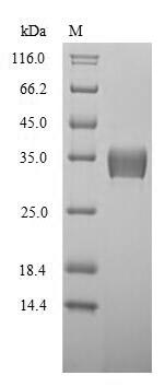 Mouse Ywhab protein
