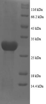 Human PLXNA1 protein