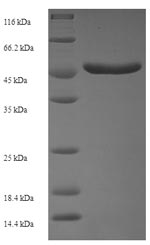 Human PAK5 protein