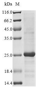 Virus A Non-structural glycoprotein 4 protein
