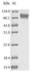 Human APPL1 protein