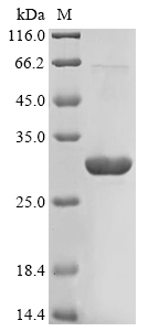 Human PYCARD protein