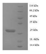 Human COL17A1 protein