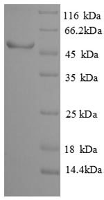 Human NEU3 protein