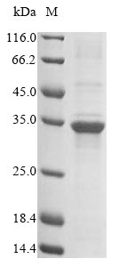 Mouse Tnni1 protein