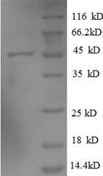 Human ARL2BP protein