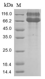 Human EPHA2 protein