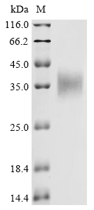 Primate EPO protein