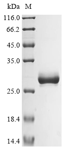 Human HSPG2 protein
