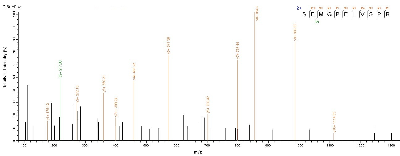 Human NPHS1 protein