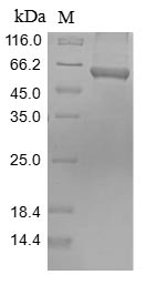 Mouse Pkm protein