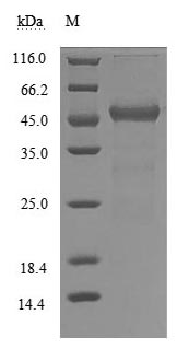 Human Transthyretin protein