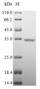 Virus Porcine parvovirus Capsid protein VP1 protein