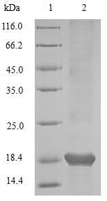 Virus A Outer capsid glycoprotein VP7 protein