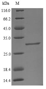 Bovine B4GALT1 protein