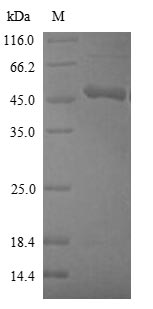 Human CBS protein
