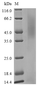 Human CHRNA3 protein