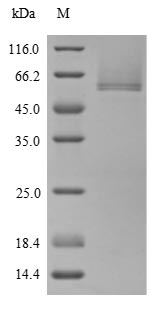 Human CILP protein