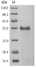 Human CTAG2 protein