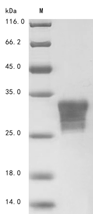 Human Orexin Receptor protein