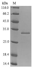 Human IGF1R protein