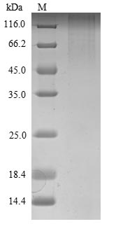 Mouse Robo1 protein