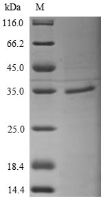 Human RPSA protein