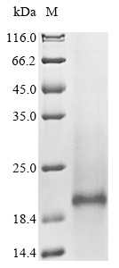 Human SLCO2B1 protein