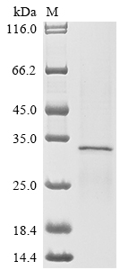Human SLCO2B1 protein