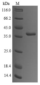 Rabbit Tropomyosin protein
