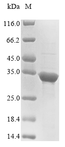 Human YJEFN3 protein
