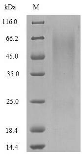 Virus A Outer capsid glycoprotein VP7 protein