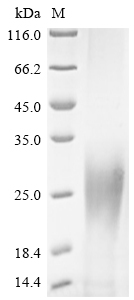 Virus GP protein
