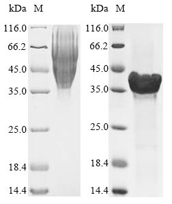 Bacteria ltxA protein