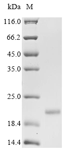 Virus X protein