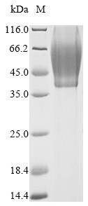 Virus PS/HR protein