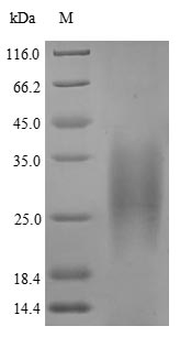 Virus PS/HR protein