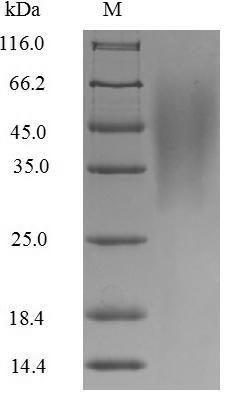 Virus Non-structural protein 1(NS) protein