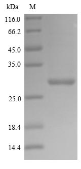 Virus Polymerase acidic protein(PA) protein