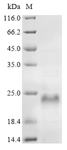 Human NACA protein