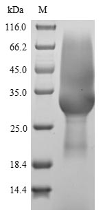 Rat Sostdc1 protein