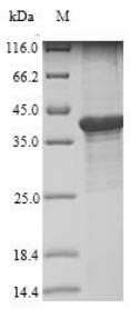 Bacteria lipA protein