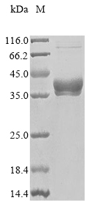 Human HSD17B13 protein