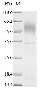 Human SFTPA1 protein