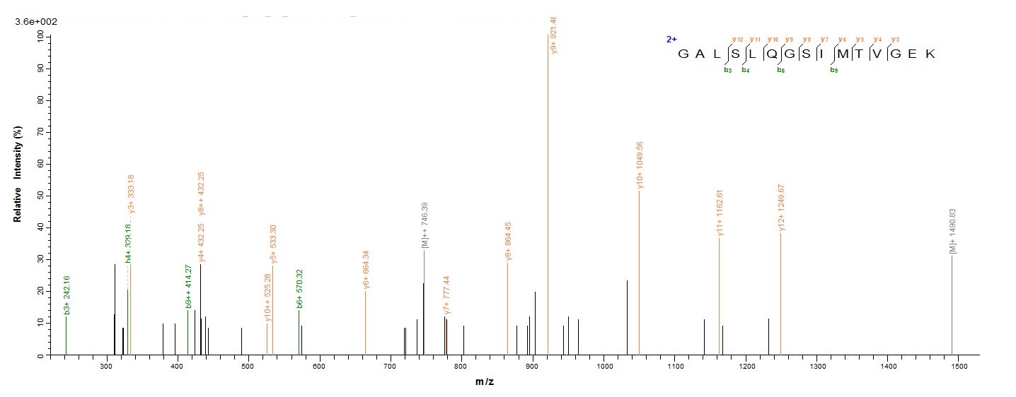 Human SFTPA1 protein