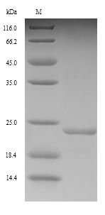 Virus nfuA protein
