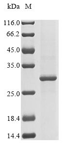 Human CELA3B protein